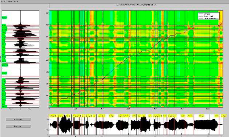 voice alignment between the narrator and lolita's future voice using Dynamic Time Warping