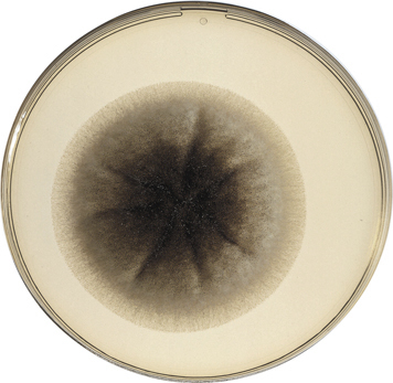 culture of mold in the middle of the white room